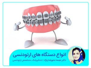 أنواع أجهزة تقويم الأسنان (الثابتة والمتحركة)